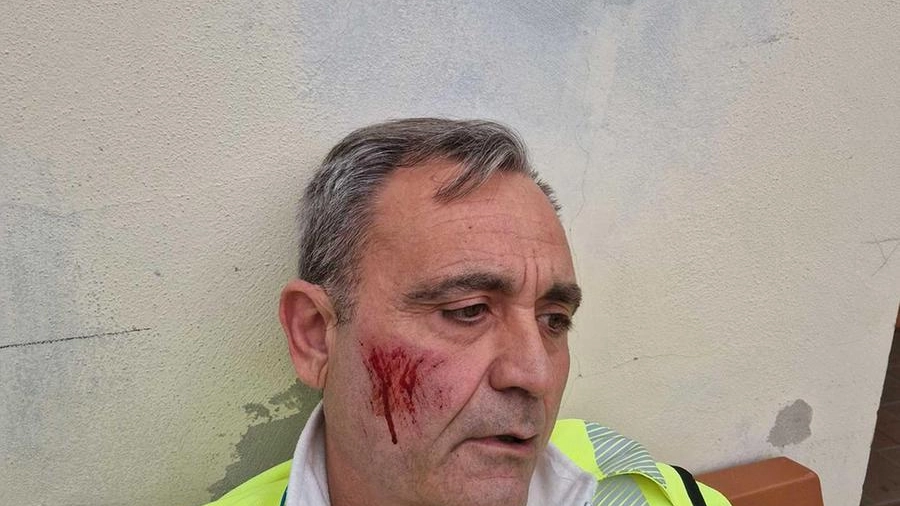 Dino Fierli, volontario della Misericordia, con i segni dell’aggressione sul volto