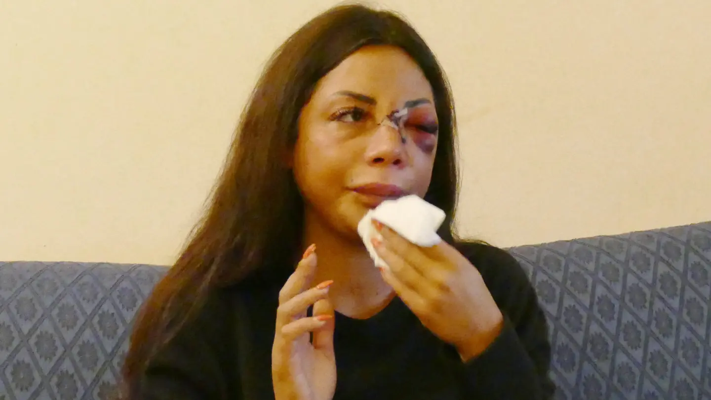 Martina Mucci, cameriera di 29 anni, pestata a sangue il 21 febbraio scorso