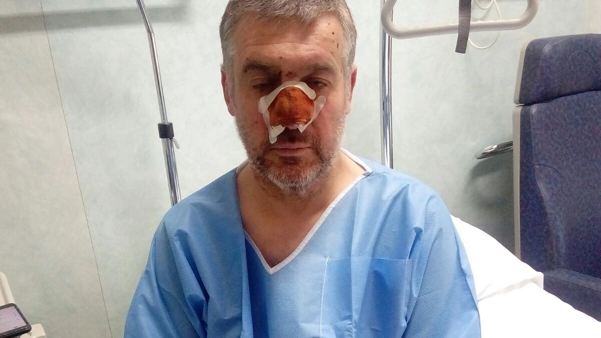 Il commerciante ferito a Pisa nella guerriglia fra stranieri