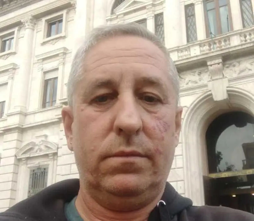 Cementificazione bella e buona