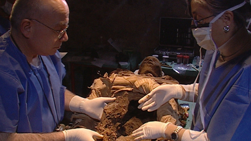 Il professor Fornaciari durante alcuni studi su una mummia