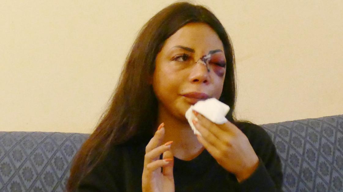 Una raccolta fondi per Martina, pestata sotto casa. &quot;Cure costose
