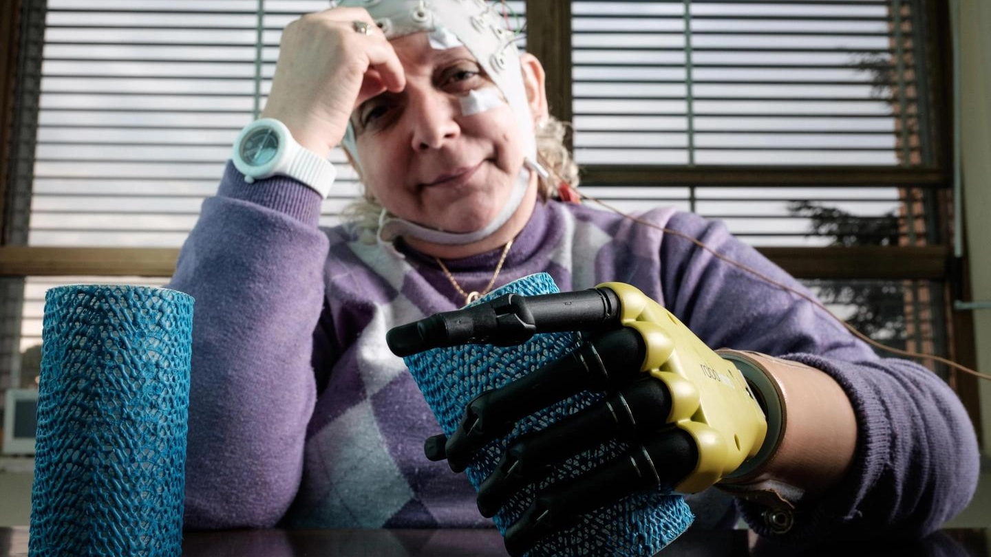 Almerina Mascarello, la donna a cui è stata impiantata la mano bionica (foto Ansa)