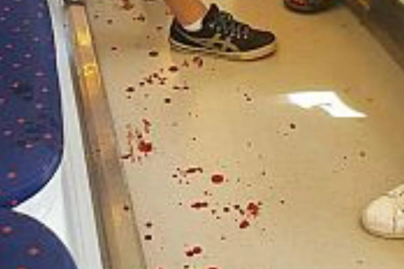 Le macchie di sangue nel vagone della tramvia 