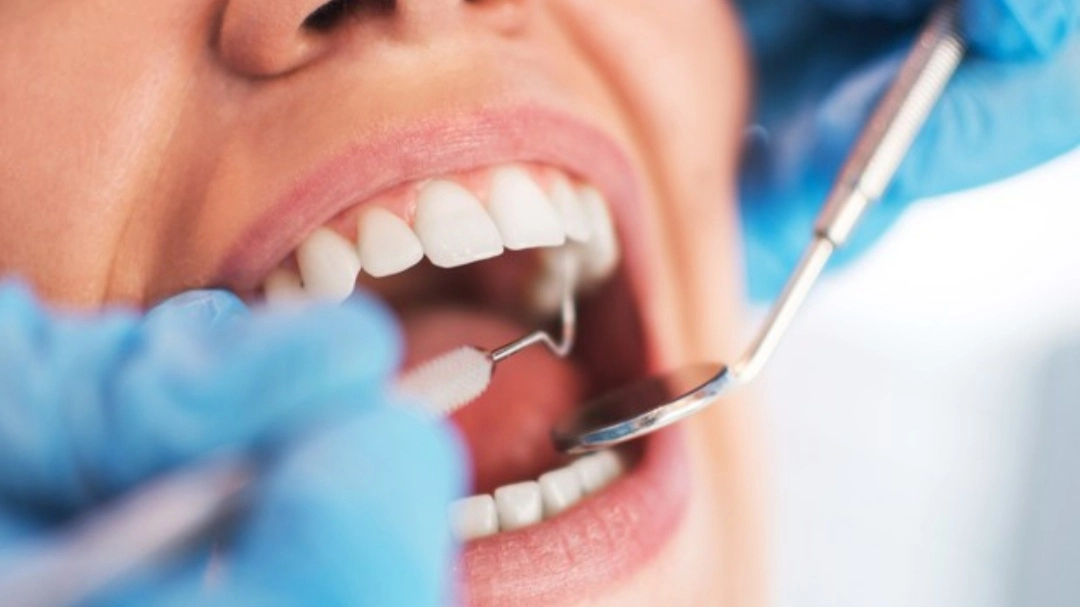 Dentista (foto di repertorio) 