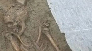 Lo scheletro umano ritrovato in via Valfonda