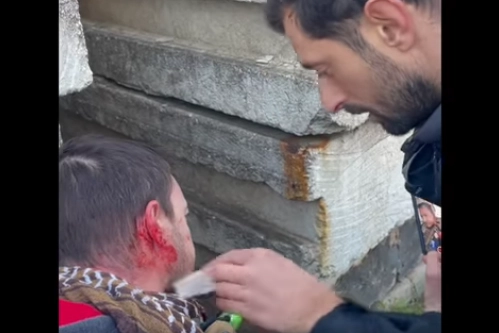 Il giornalista Locatelli ferito (frame dal video Facebook di Claudio Locatelli)