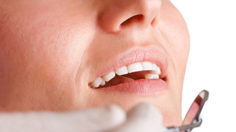Igiene orale, denti, dentista: foto generica (Alamy Stock Photo)