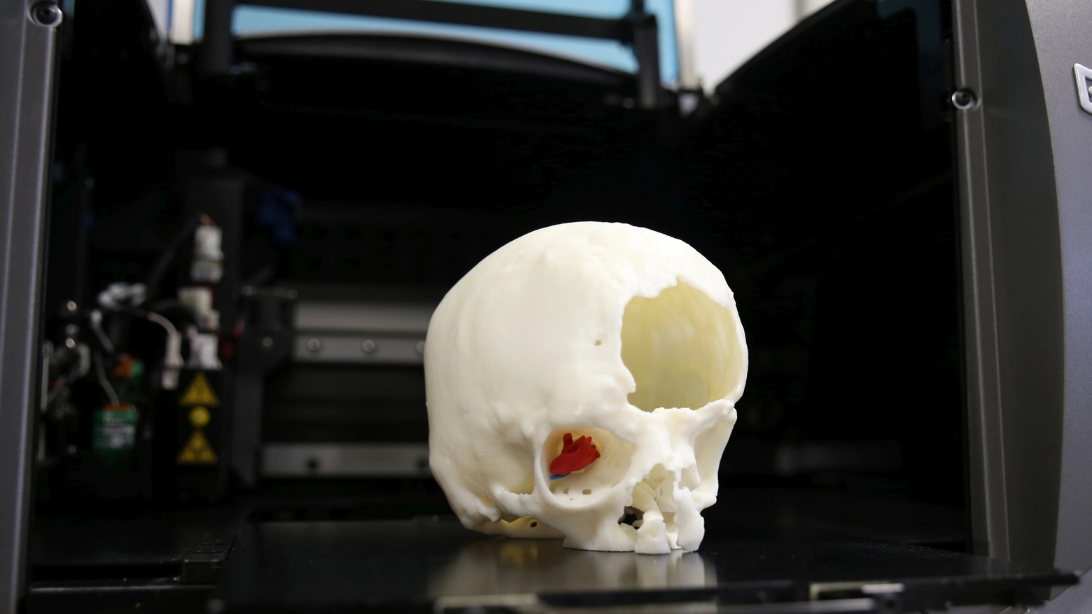 Il cranio realizzato con la stampa 3D