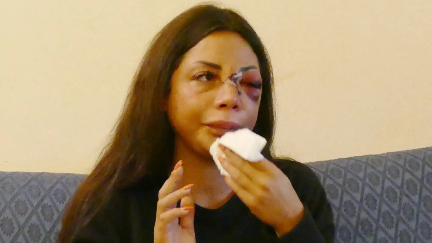 Martina Mucci, 29 anni, picchiata davanti a casa nella notte fra il 20 e il 21 febbraio