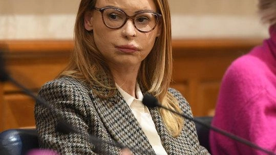 Lucia Annibali il 16 aprile 2013 subì una violenza aggressione da parte di due sicari assoldati dal suo ex fidanzato, che non si rassegnava alla fine della loro relazione