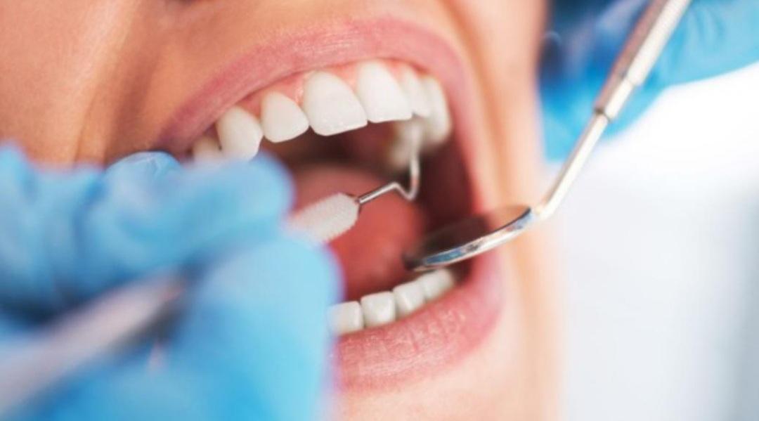 https://www.lanazione.it/image-service/view/acePublic/alias/contentid/MDI4ODJlZjMtNWRjOS00/0/cure-odontoiatriche.jpeg
