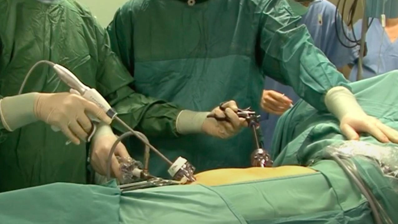 La riduzione degli anestesisti all'ospedale Apuane solleva critiche e preoccupazioni per le emergenze in sala parto. La riduzione degli anestesisti all'ospedale Apuane solleva critiche e preoccupazioni per le emergenze in sala parto.