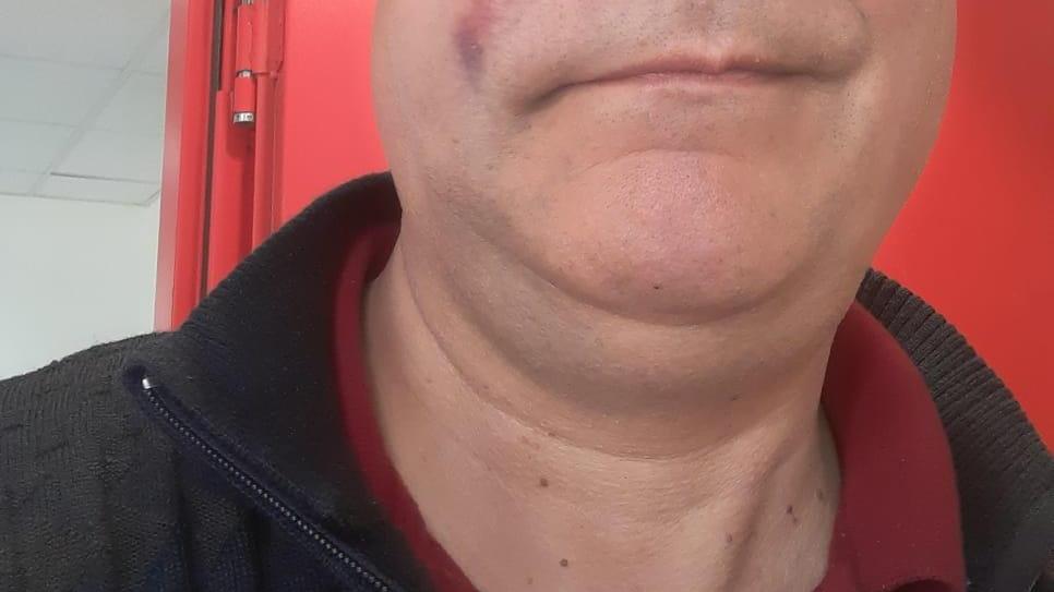 AREZZO Aggredito autista di bus: "Aumentare i controlli a bordo" AREZZO Aggredito autista di bus: "Aumentare i controlli a bordo"