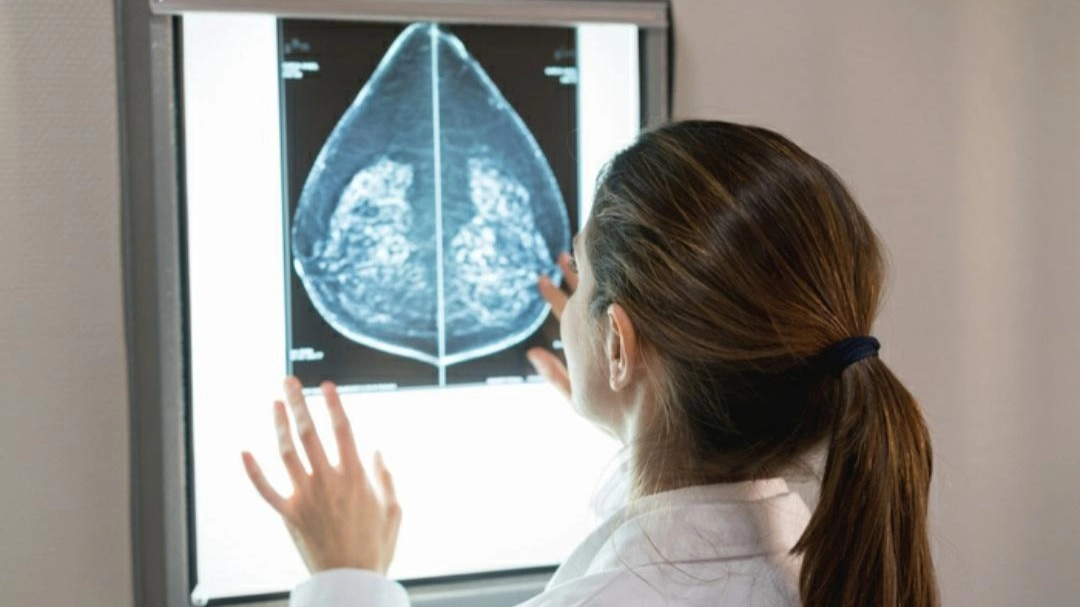 Prevenzione del tumore al seno