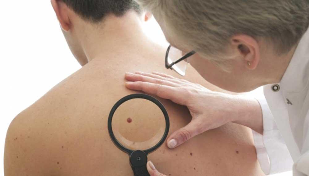 Ha un carcinoma, deve fare una visita entro 3 giorni: “La prima data disponibile? Tra cinque mesi” Ha un carcinoma, deve fare una visita entro 3 giorni: “La prima data disponibile? Tra cinque mesi”