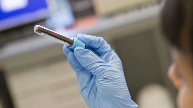 Si attende la conferma definitiva del presunto caso di West Nile a Chianciano Si attende la conferma definitiva del presunto caso di West Nile a Chianciano