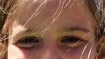 Sofia Bernkopf, la bimba di 12 anni annegata il 13 luglio 2019 nella piscina del bagno Texas a Marina di Pietrasanta Sofia Bernkopf, la bimba di 12 anni annegata il 13 luglio 2019 nella piscina del bagno Texas a Marina di Pietrasanta
