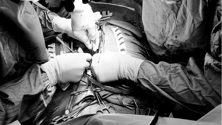 Un intervento nella sala operatoria di cardiochirurgia di Aoup Un intervento nella sala operatoria di cardiochirurgia di Aoup