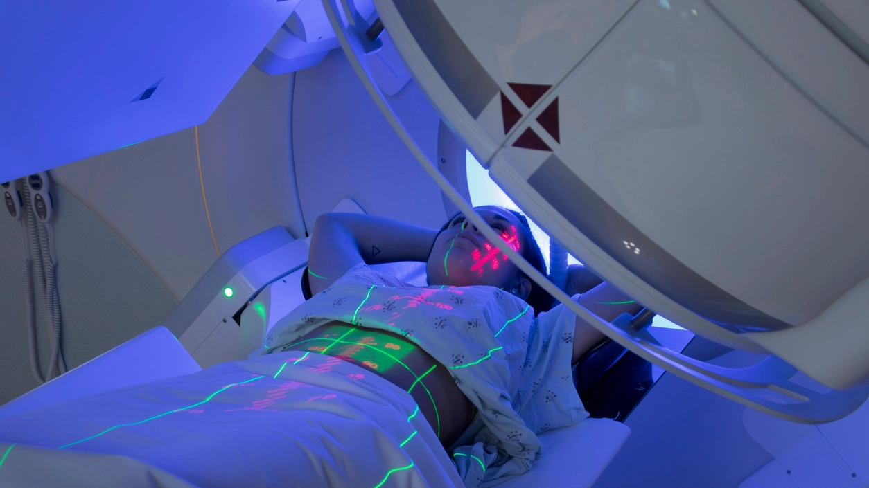 La radioterapia offre trattamenti sempre più mirati e personalizzati sulla specificità della patologia tumorale