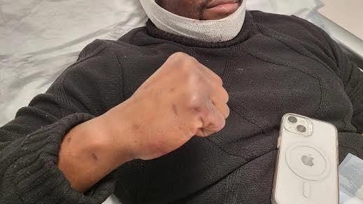 Abdoulaye Mballo, 33 anni, aggredito con un machete alla testa Abdoulaye Mballo, 33 anni, aggredito con un machete alla testa