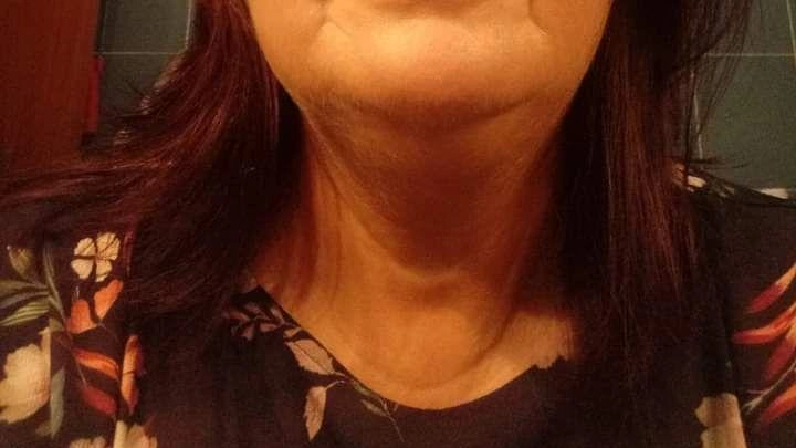 Rossana Lombardi, 60 anni, di Piano di Collecchia, è deceduta improvvisamente al Noa di Massa. La comunità locale è colpita dalla perdita di questa donna, ricordata come un angelo custode durante le ricerche del padre scomparso. I funerali si terranno oggi nella chiesa parrocchiale di Piano di Collecchia. Rossana Lombardi, 60 anni, di Piano di Collecchia, è deceduta improvvisamente al Noa di Massa. La comunità locale è colpita dalla perdita di questa donna, ricordata come un angelo custode durante le ricerche del padre scomparso. I funerali si terranno oggi nella chiesa parrocchiale di Piano di Collecchia.
