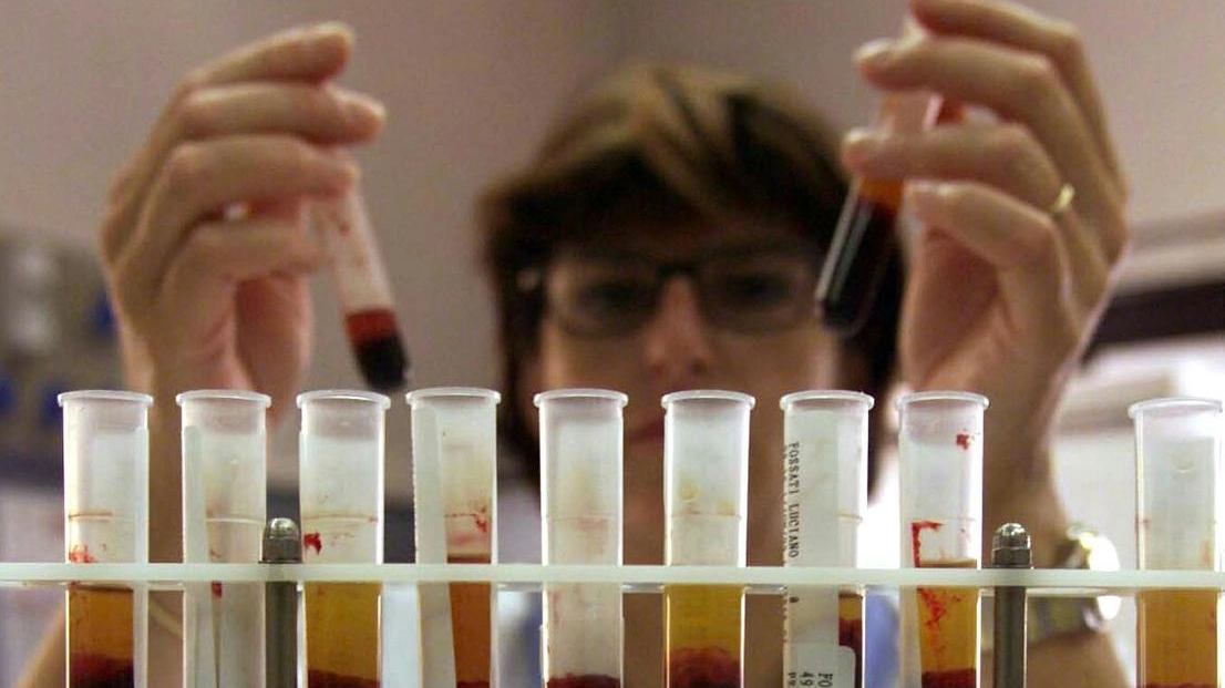 La trasfusione è stata fatta nel 1976, la donna si è sentita male nel 2017 La trasfusione è stata fatta nel 1976, la donna si è sentita male nel 2017