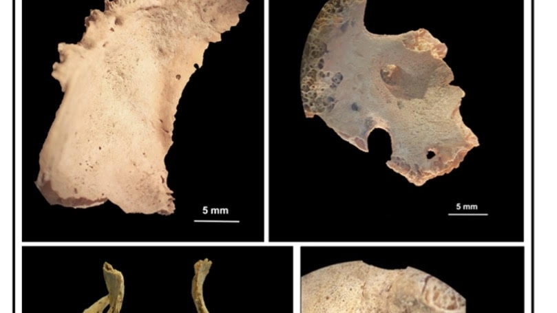 Lo studio dell'Università di Pisa. L’analisi dei resti umani osteoarcheologici risalenti al periodo etrusco ha rivelato come l’'intensificazione agricola avvenuta nel I millennio a.C. abbia causato l’insorgenza di avitaminosi C
