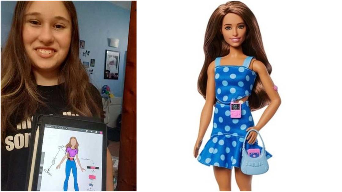 Ecco la Barbie col diabete. Quell’idea già proposta da Pistoia Ecco la Barbie col diabete. Quell’idea già proposta da Pistoia